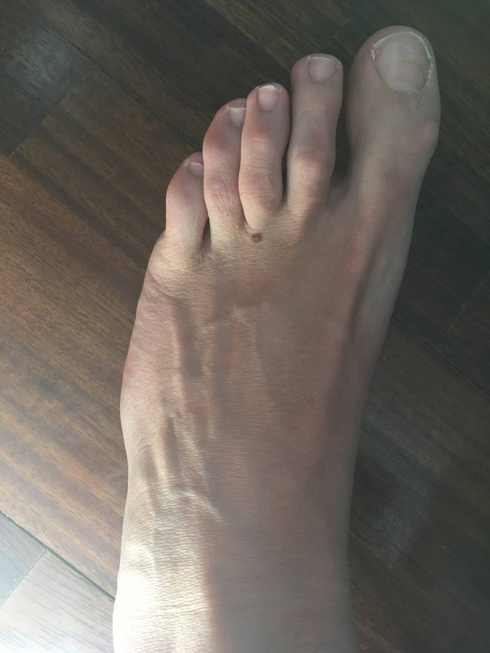 Foot4u OnlyFans – free nudes, naked, leaked